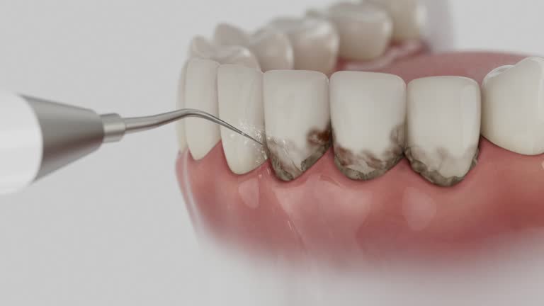 Reliable Dental Implants contractor in Rogers, TX by Smile Center Dentistry